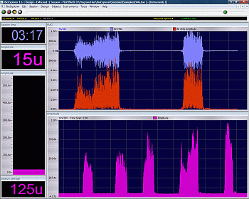 Elektromyographie (EMG)