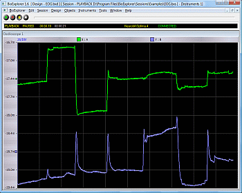 Elektrookulogramm (EOG)