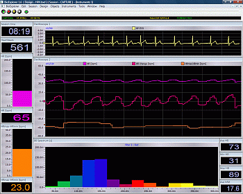 Heart Rate Variability (HRV)